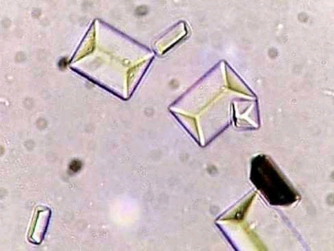 urine