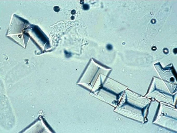 urine