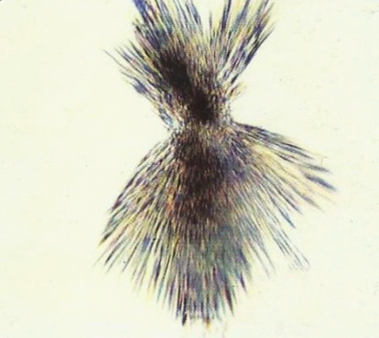 urine
