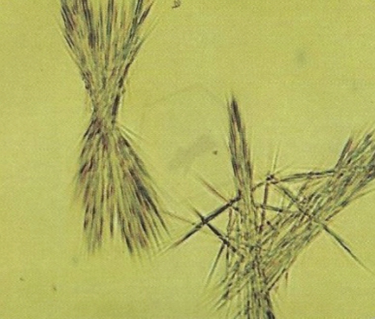 urine