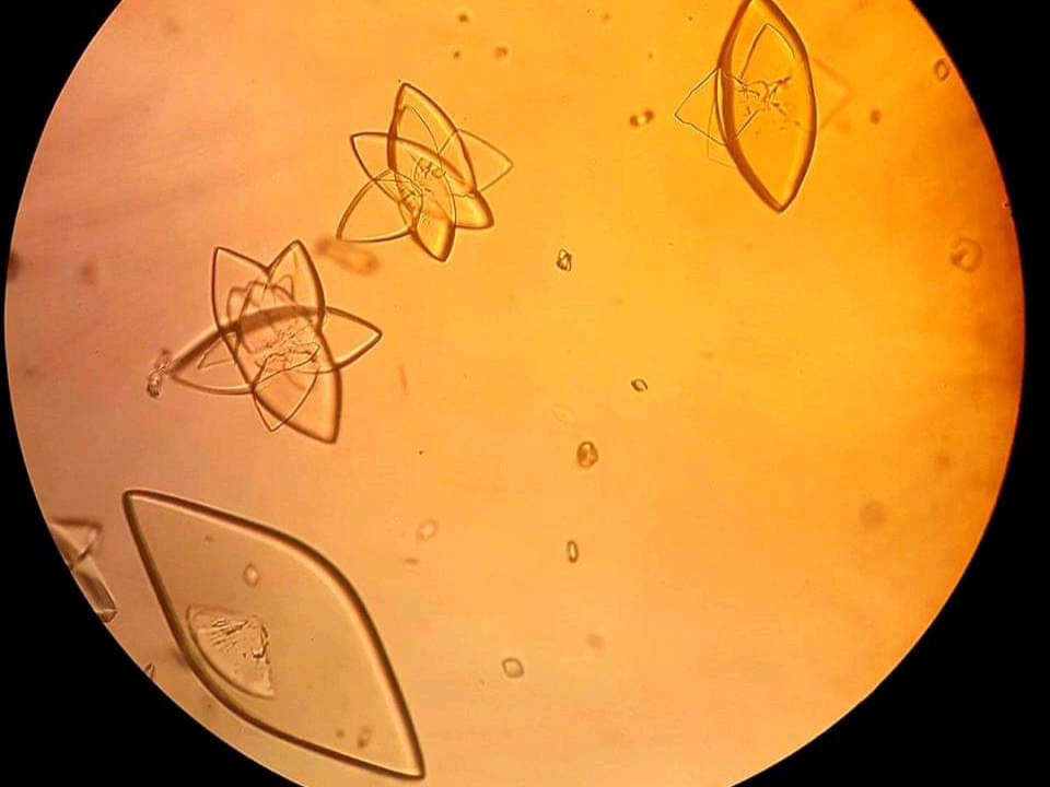urine