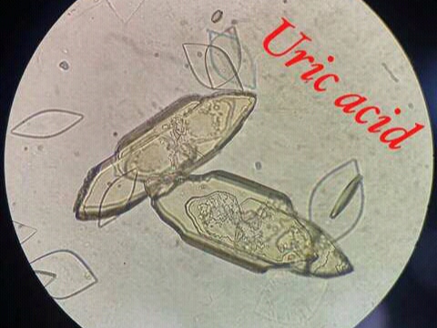 urine