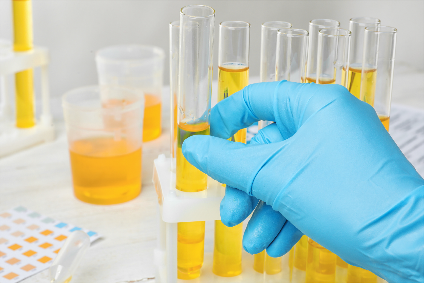 urine img
