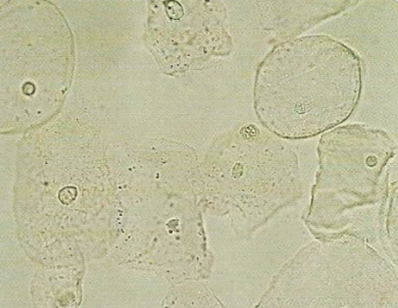 urine