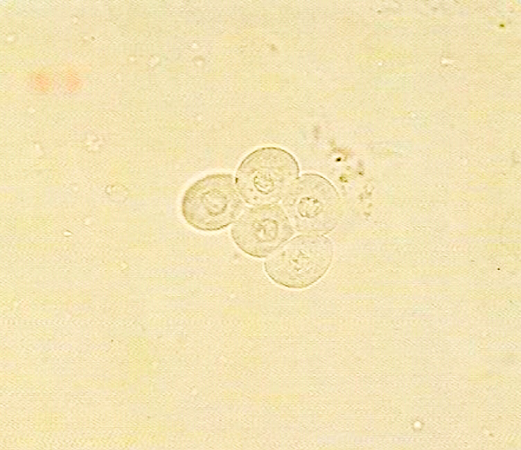 urine