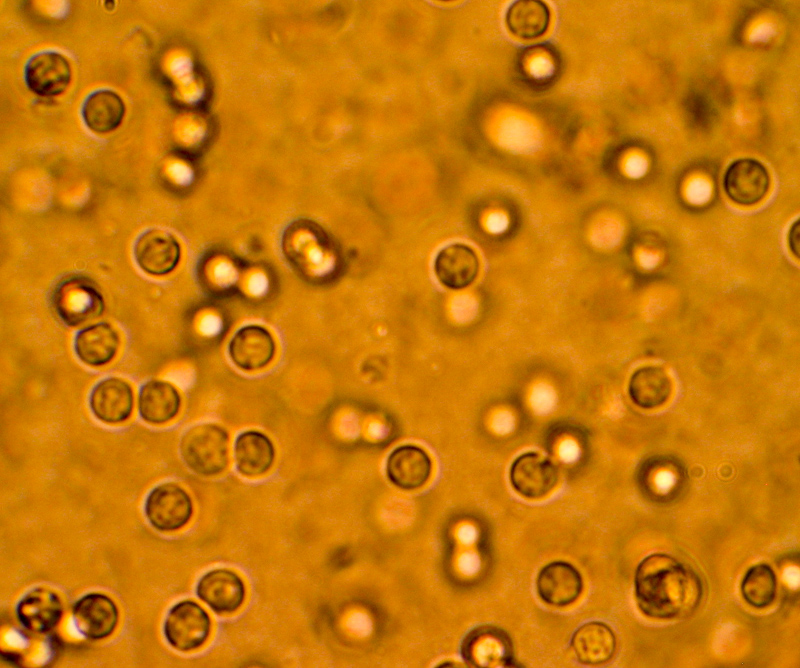 urine
