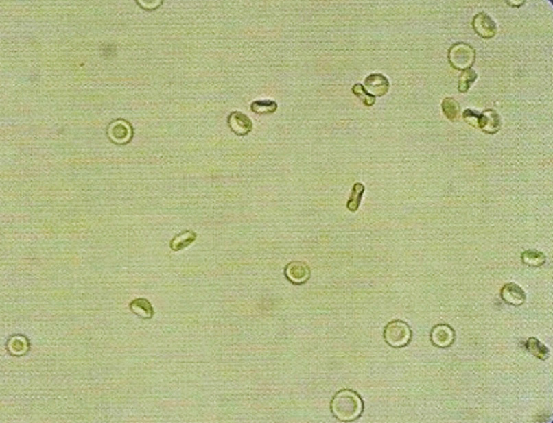 urine