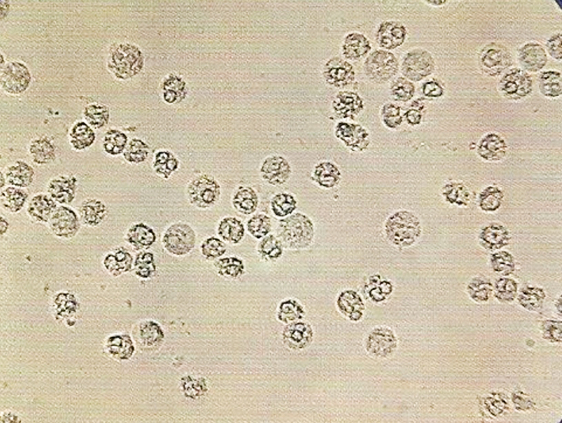 urine